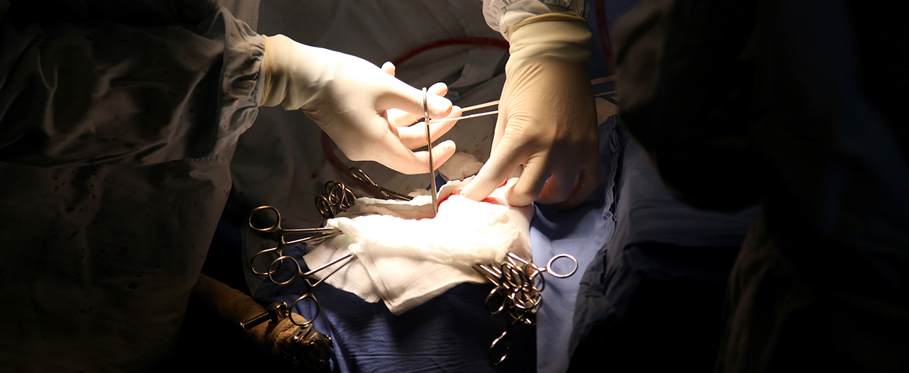 Красноярские хирурги удалили глиобластому с помощью спрея
